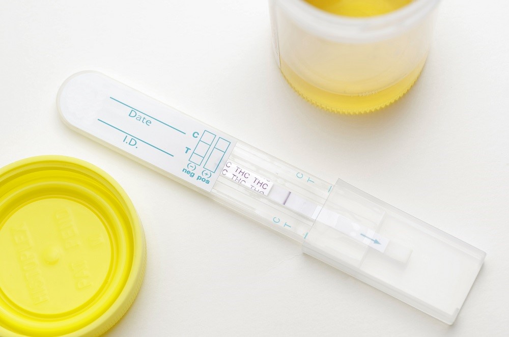 Synthetic Urine Use Muir San Jose CA